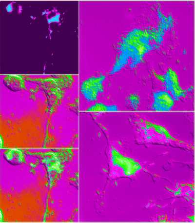 Photo montage of the bacterium Burkholderia pseudomallei