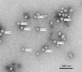 0965843_2012_tem_image_of_chitosan-gentamicin_cuccarese_igert_northeastern